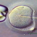 fertilização in vitro