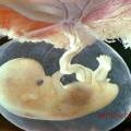 Placenta sua função na gravidez