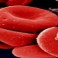 Anemia ferropriva em Grávidas e Crianças