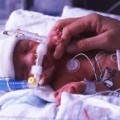 bebê prematuro em UTI neonatal