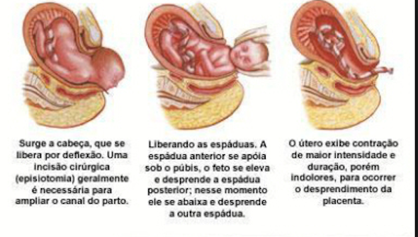 Como é o Parto normal 2 Como é o Parto normal 2